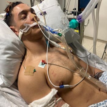 Jason in hospital, on a ventilator