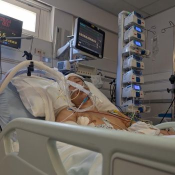 Phoenix in hospital on a ventilator