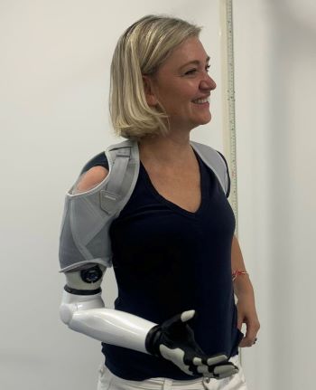 Sarah with her AI-powered bionic arm