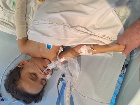 Harrison in a hospital bed, on a ventilator